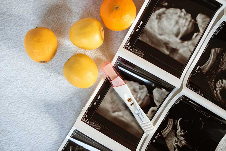 جهاز فحص الحمل و صور طبقية